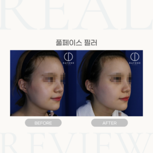 풀페이스 필러