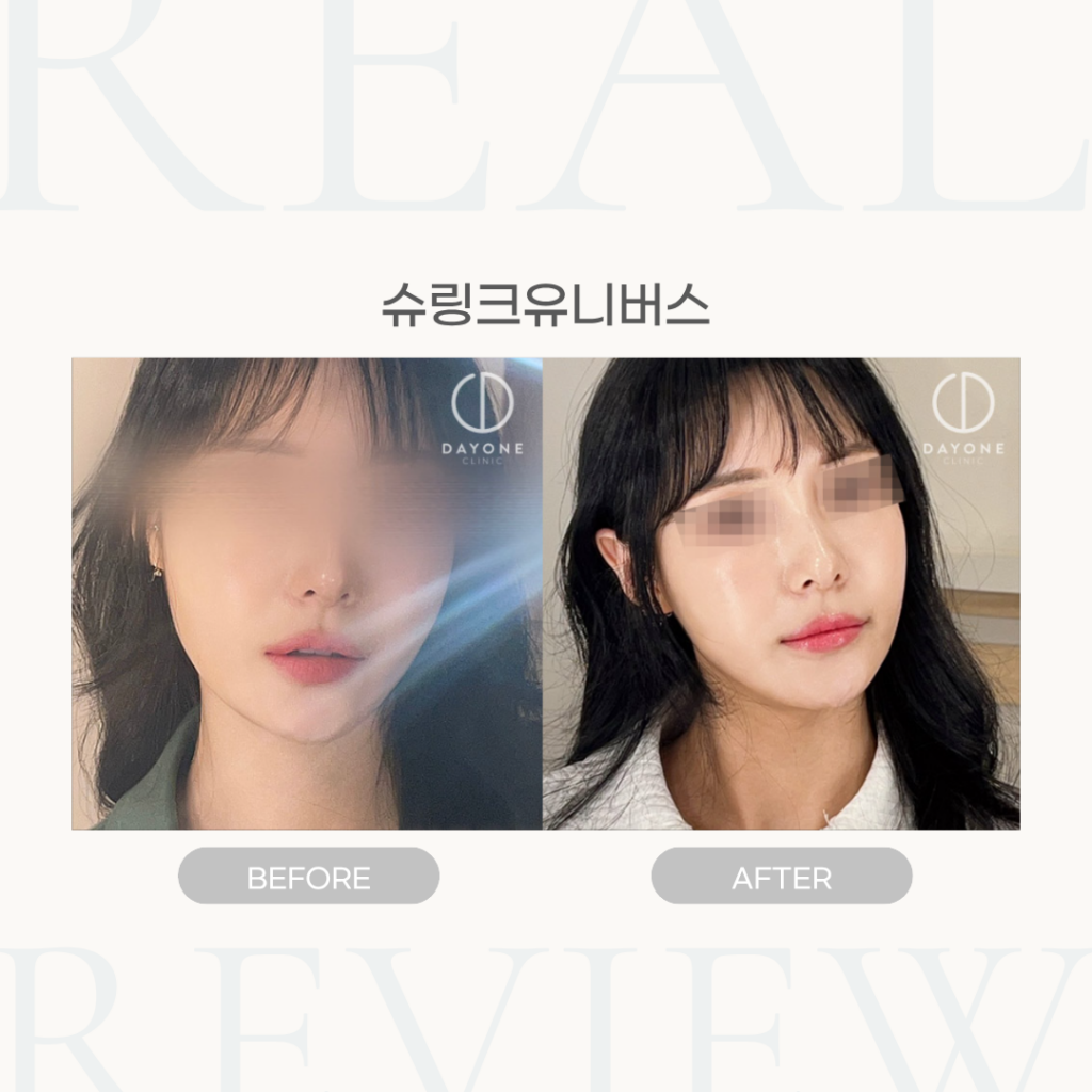 슈링크유니버스