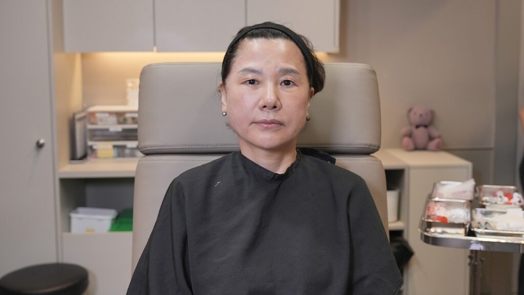 내일 중요한 약속이 있는 65세 실리프팅 인대강화주사 라이브