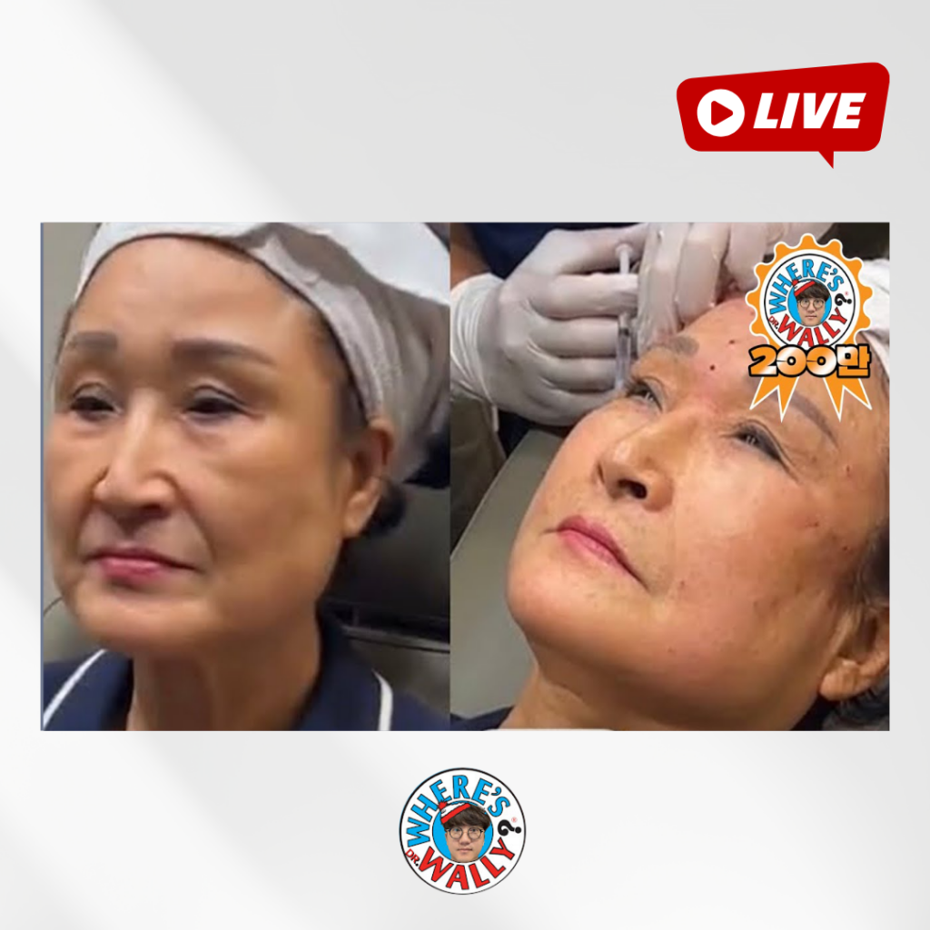 70대의 리프팅! A Lifting procedure for people in their 70’s!