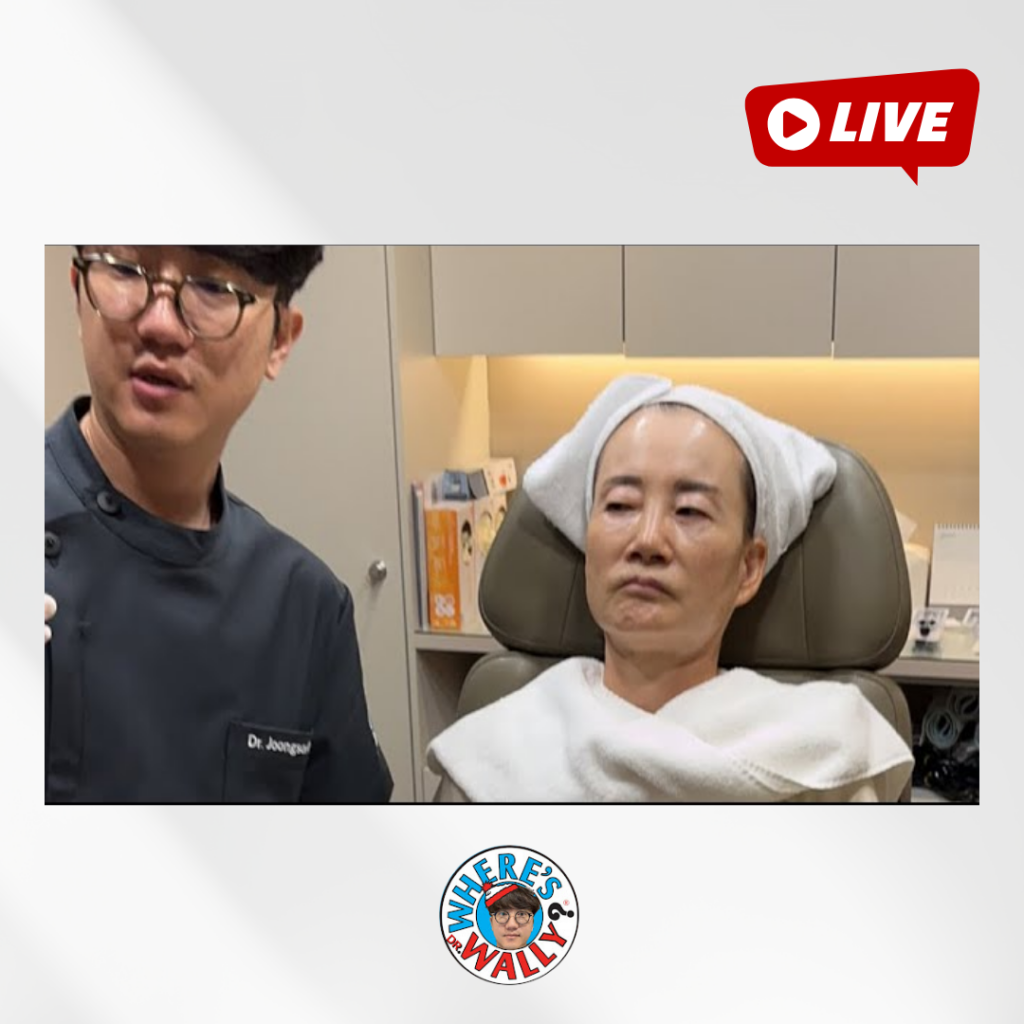 닥터월리의 어머니(53년생) 60대이상 입주변 주름 시술
