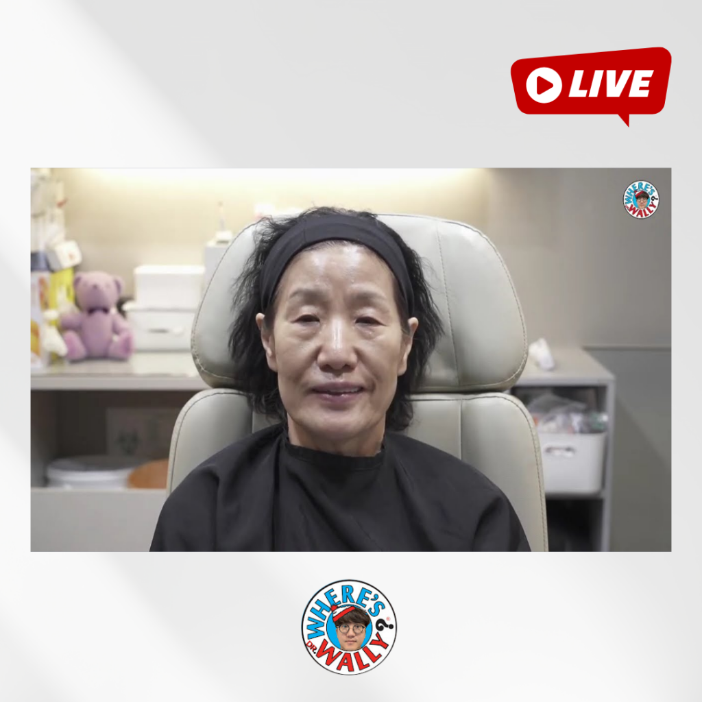 69세 입주변 주름, 한 달 남은 자녀 결혼식 전에 해결하기!