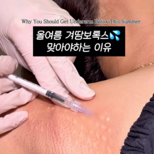 올 여름 겨땀복톡스 맞아야 하는 이유!
